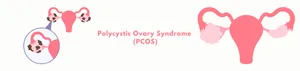 Polycystic Ovary Syndrome (PCOS)