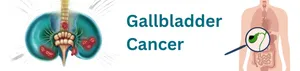 Gallbladder Cancer